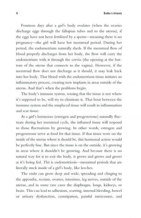 EndoMEtriosis: A Guide for Girls