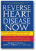 Reverse Heart Disease Now: Stop Deadly Cardiovascular Plaque Before It's Too Late book cover