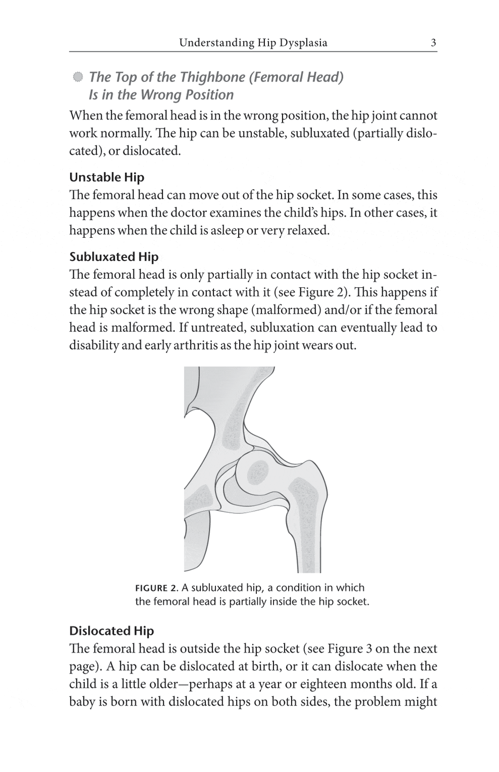 The Parents' Guide to Hip Dysplasia — Turner Publishing
